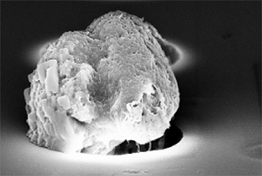 An electron microscopy photo of a circulating tumor cell being captured by the filter-based microdevice developed by a group of scientists and physicians at the Miller School of Medicine, University of Miami. Reprinted from Cancer Biomarkers, 9(1–6); “Micrometastases: detection methods and clinical importance,” pp. 397–419, Balic M, Williams A, Dandachi N, Cote RJ. ©2010, with permission from IOS Press.