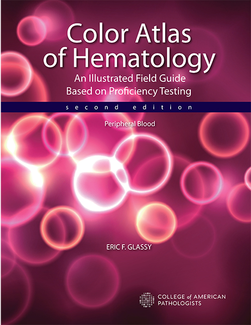 Color atlas of hematology glassy pdf editor