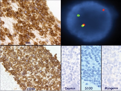 Samples of static images that accompany the Touch Imprint/Crush Prep cases.