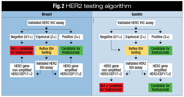 The gastric cancer HER2 testing algorithm advocated for by University of Rochester (NY) pathologists (right) differs from the CAP/ASCO HER2 testing algorithm for breast cancer (left).