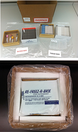 Figure. Examples of kit contents (A) and packaging for shipment (B)