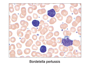 Fig.5. Bordetella pertussis