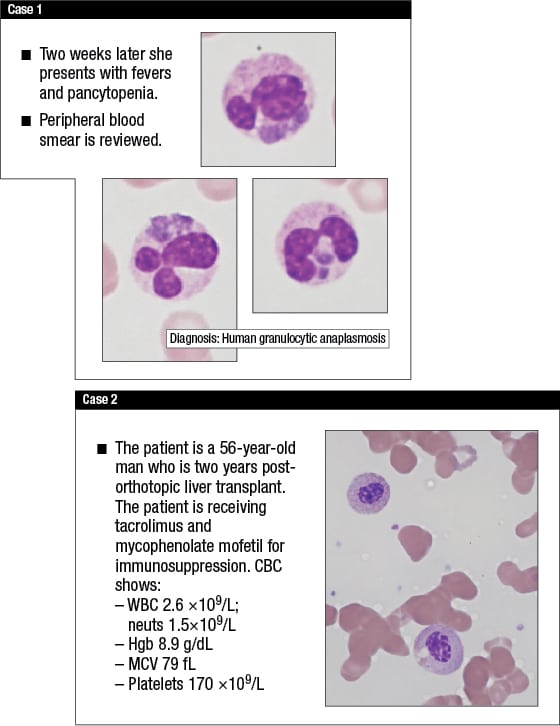cytopeniasCase1-2