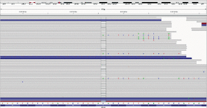 Fig. 3: Next-generation sequencing results showing deletion of C in the BRCA2 gene. (See Fig. 4.)