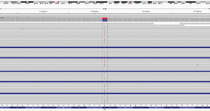Fig. 1: Results from next-generation sequencing showing a substitution from C to T in the APC gene.