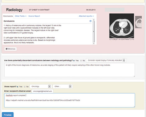 Screenshots offer a sample of how UCLA’s RadPath system gives clinicians a single diagnostic report (left) and offers pathologists and radiologists a means to find and resolve discordances (right). Source: May 5, 2014 Executive War College presentation by Drs. Wallace and Arnold.