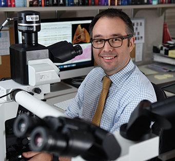 “Basically, when you’re talking about endomyocardial biopsy, it makes sense to broadly dichotomize the issue into the two categories that make sense clinically: transplant related and nontransplant related,” says Dr. Joseph Maleszewski (right).