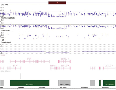 Fig 1. Chromosomal microarray result showing 83 kilobase interstitial deletion on Xq28. Xq28 deletion and normal flanking regions in the patient and his sister. The copy number state shows a red bar indicating the area of loss on chromosome X. The Log2 Ratio, Weighted Log2 Ratio, and Allele tracks show loss of signal in the region from positions 154,246,916-154,329,983 (GRCh37/hg19). In this case there is one copy of the flanking regions but zero copies in the 83 kilobase deletion. The smooth signal gives a best fit for the array data across that region. Genes are listed below the data tracks and show that the 5′ regions of F8 and BRCC3 are lost. FUNDC2, MTCP1, and CMC4 are fully removed by the deletion. The genomic coordinates and chromosomal position are listed at the bottom.