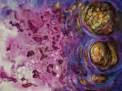 “Pathology of Sunlit River Rocks” by Lizzy Rainey, radiologic technologist. Acrylic on canvas, photograph by Andrew Farmer. In this painting, with the guidance of Ken Fortress, MD, pathologist at St. Elizabeth Hospital, Lafayette, Ind., Rainey has “portrayed the ugliness of malignant ovarian tumors as glistening river rocks surrounded by gently flowing water. The water flowing from the rocks gradually transforms into the magenta color, painted to resemble a pathology slide of breast cancer.”