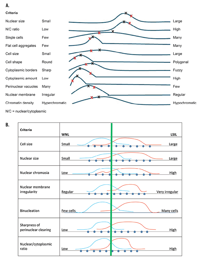 Fig. 2. A. Pap test low-grade squamous intraepithelial lesion (LSIL) pattern spectrum for an expert pathologist. The black Xs show a “classic” case (every criterion is at the median frequency distribution). Patient VK’s Pap test criteria are shown by the red Xs. B. Expert’s within normal limits (WNL) LSIL criteria comparison.