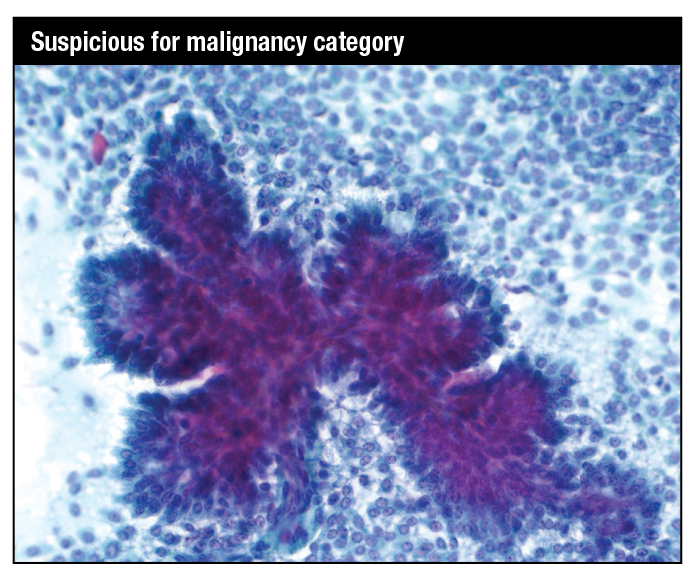 SusMalignancyCategory