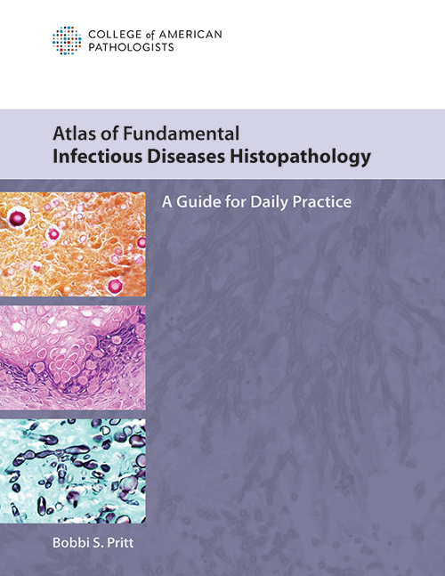 InfectiousFrontCover