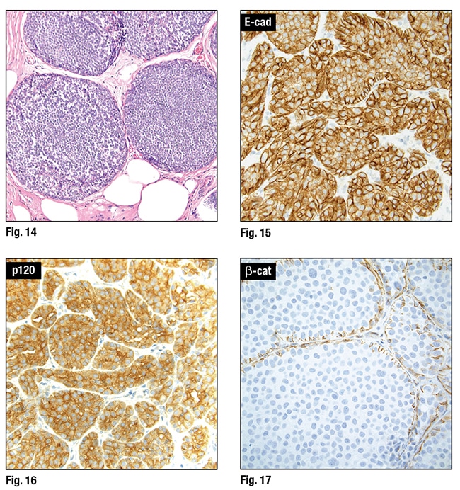 Breast_Figure14151617