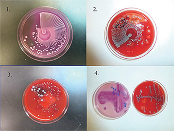 Culture plates (1–3) are streaked by using an automated system (Previ Isola). Fig. 1 is the MacConkey agar plate. Figs. 2 and 3 are the blood agar plate. Fig. 3 is a mixed culture with nice colony separation, which can be used directly for MALDI-TOF MS. For comparison, the culture plate 4 is streaked manually. Photos provided by Yun Wang, MD, PhD.