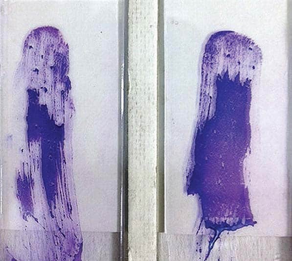 Macroscopic view of air-dried, smeared slides, modified Giemsa stain