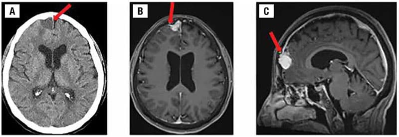 Preoperative radiological images