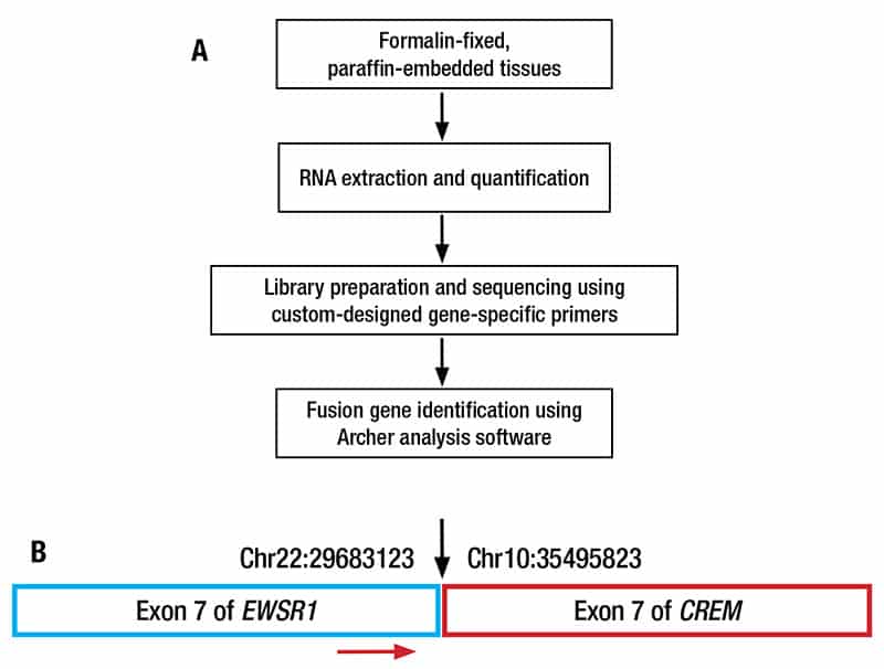 Identification of the EWSR1::CREM fusion gene through MSK-Fusion