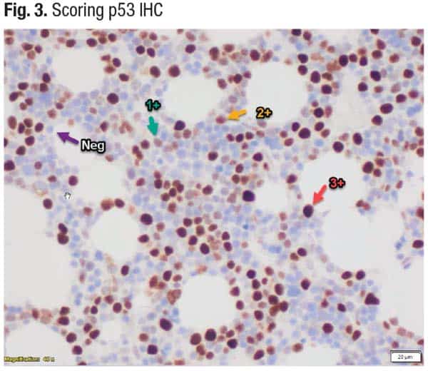 Scoring p53 IHC