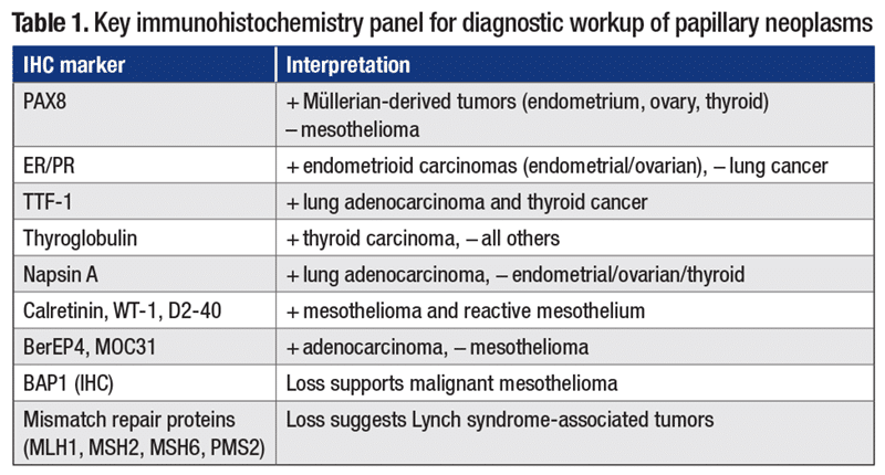 Table 1. Key immunohistochemistry panel for diagnostic workup of papillary neoplasms