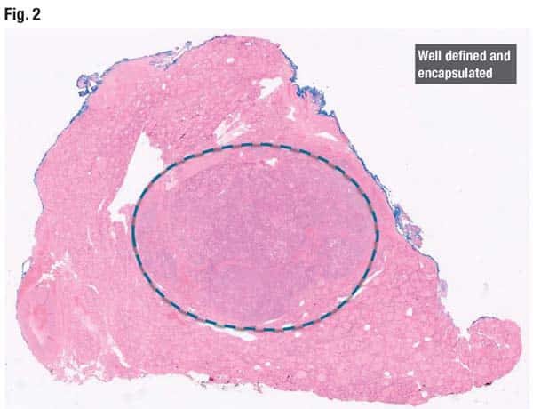 Fig. 2. Well defined and encapsulated