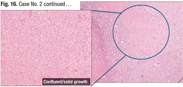 Fig. 16. Case No. 2 continued