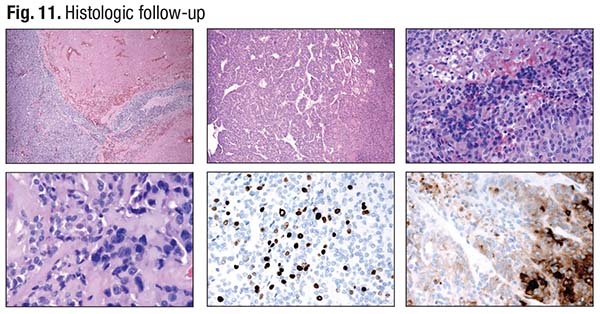 Fig. 11. Histologic follow-up