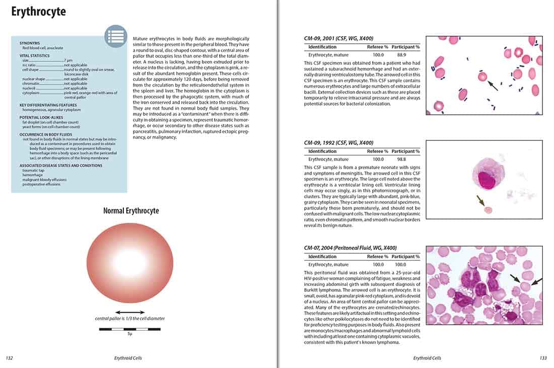 Color Atlas of Body Fluids: An Illustrated Field Guide Based on Proficiency Testing