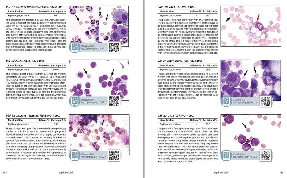 Color Atlas of Body Fluids: An Illustrated Field Guide Based on Proficiency Testing