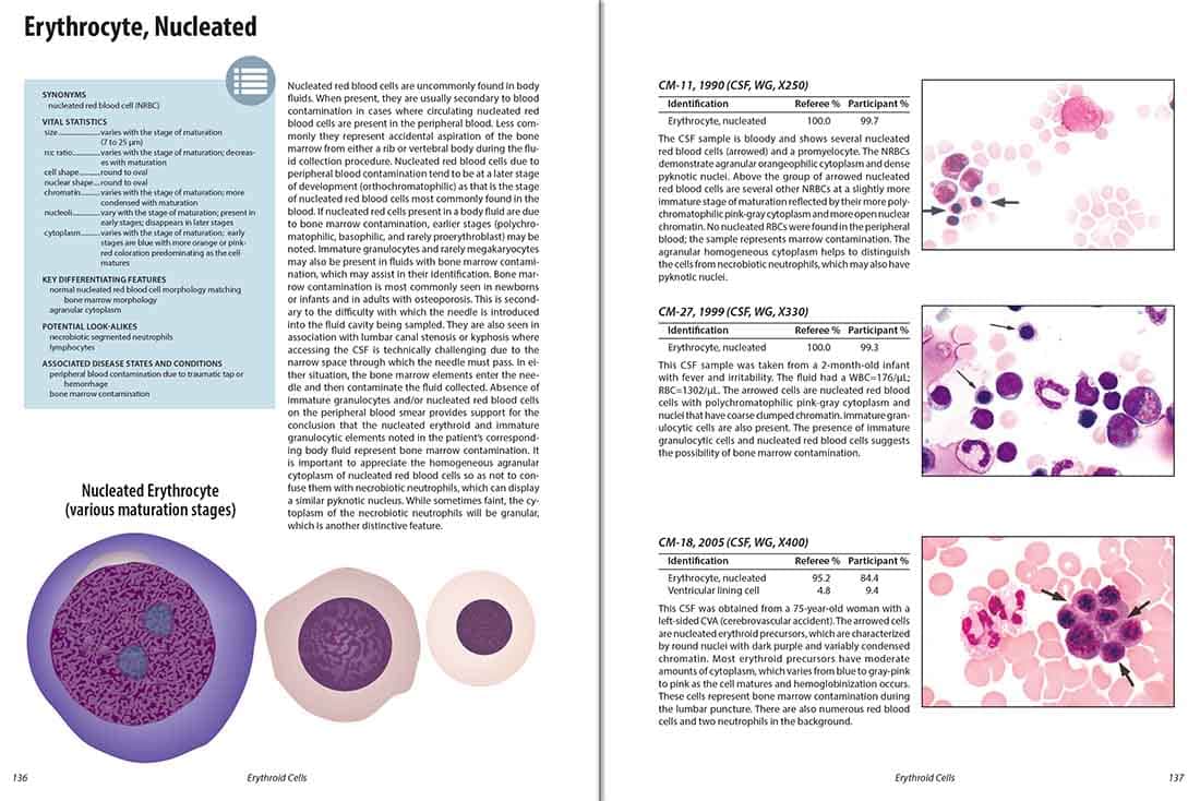 Color Atlas of Body Fluids: An Illustrated Field Guide Based on Proficiency Testing