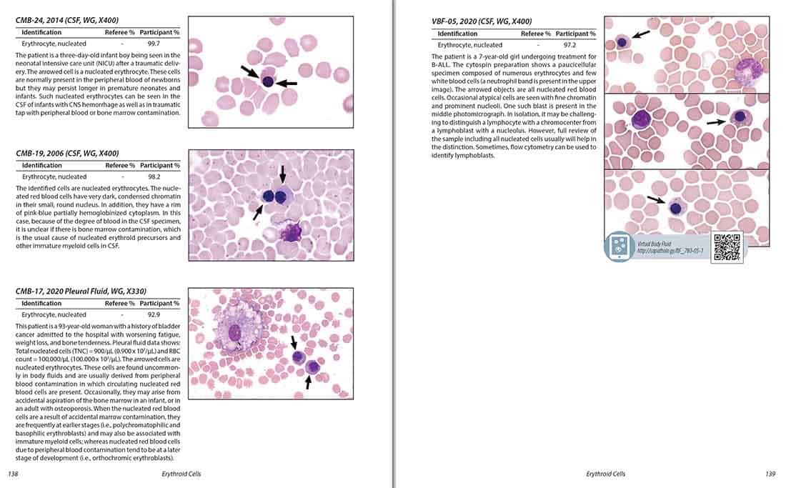 Color Atlas of Body Fluids: An Illustrated Field Guide Based on Proficiency Testing