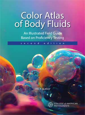 Color Atlas of Body Fluids book cover