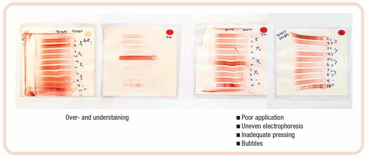 Fig. 3. Problem gels