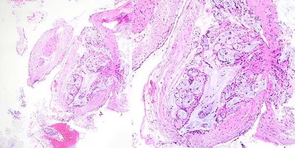 Submucosal glands