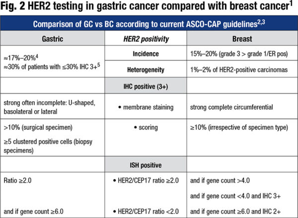 HER2 scoring in gastric cancer and other solid tumors - CAP TODAY