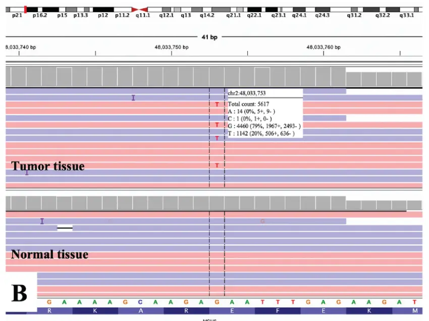 Integrative Genomics Viewer (IGV) view of POLE and MSH6 variants