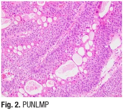 Fig. 2. PUNLMP