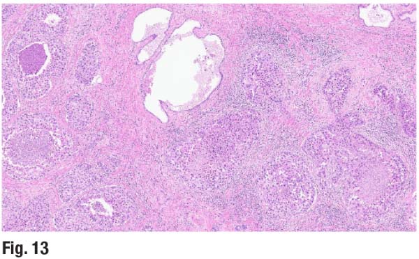 Fig. 13