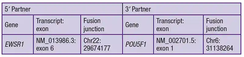 EWSR1::POU5F1 fusion breakpoints.