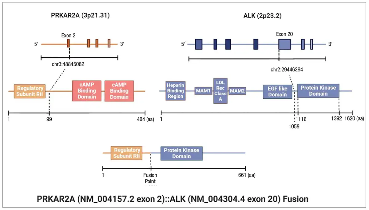 Predicted in-frame activating PRKAR2A::ALK fusion